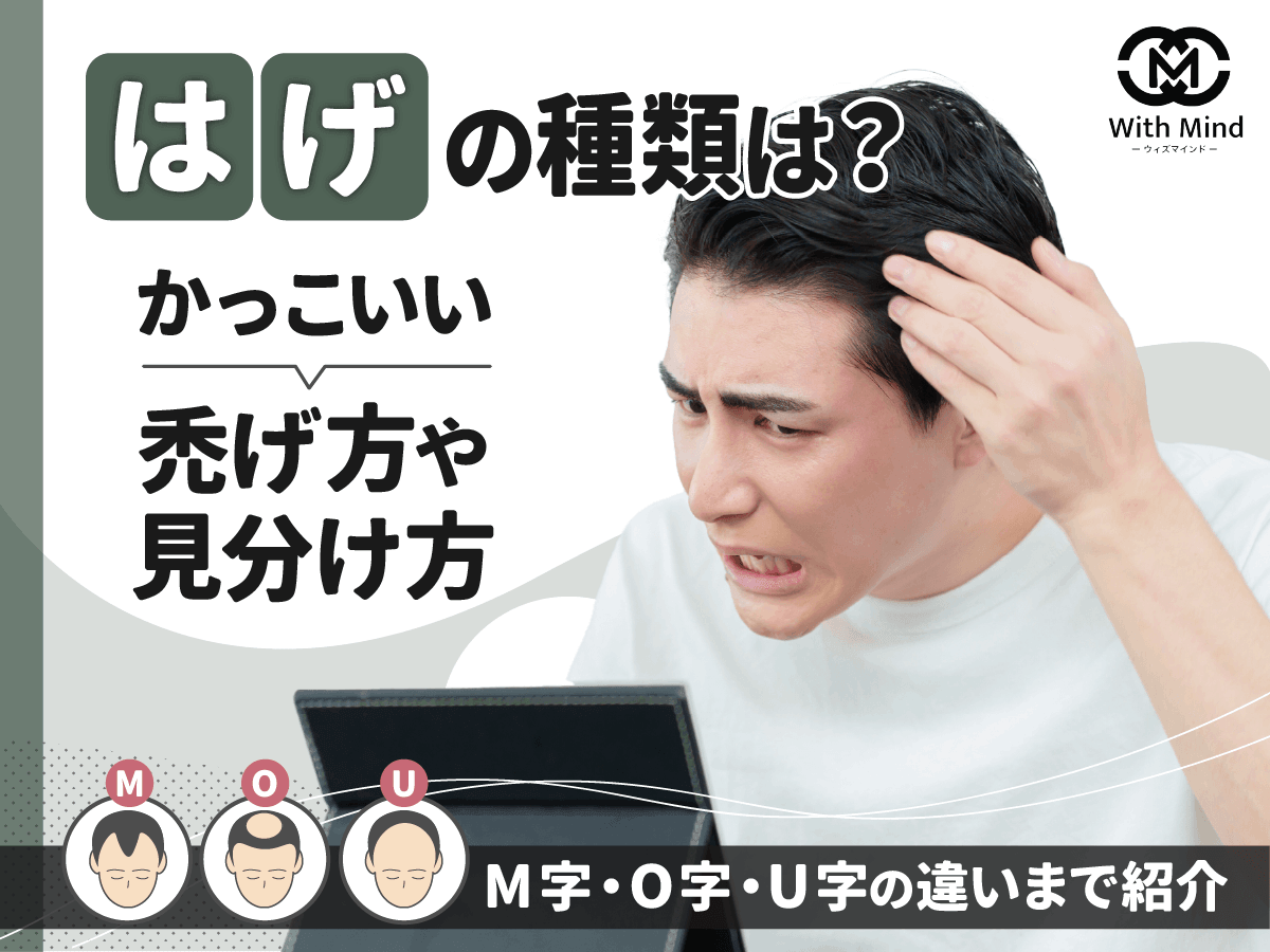 はげの種類は？かっこいい禿げ方や見分け方とM字・O字・U字の違いまで紹介