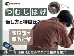 つむじはげの治し方とどこから症状は？思い込みの頭頂部はげを避けて適切な対策をする方法