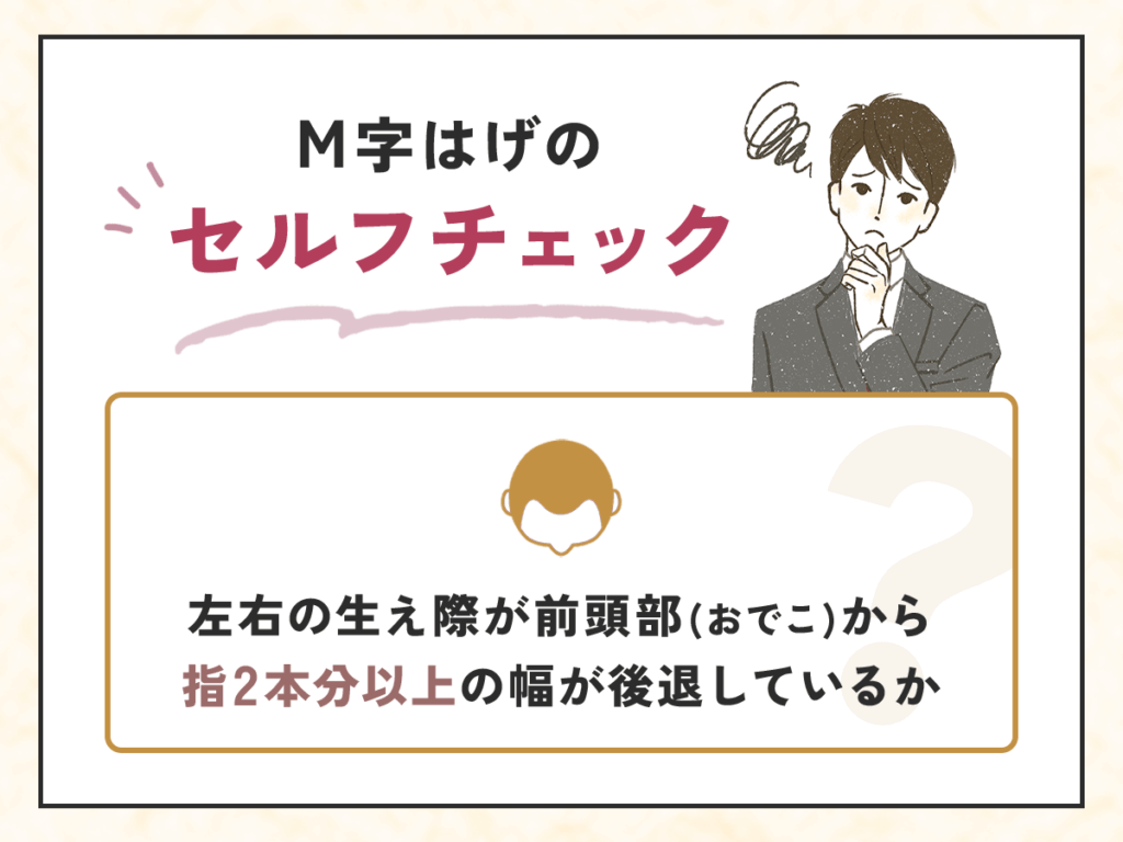 左右の生え際が前頭部（おでこ）から指2本分以上の幅が後退しているか