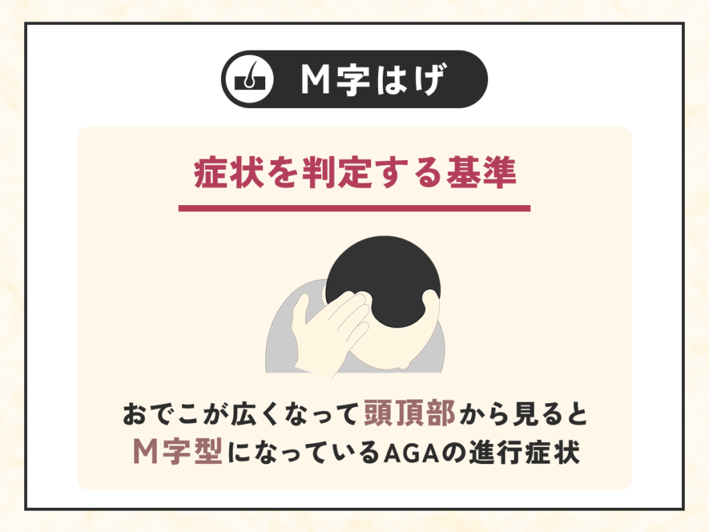 M字はげ・M字ハゲの症状を判定する基準